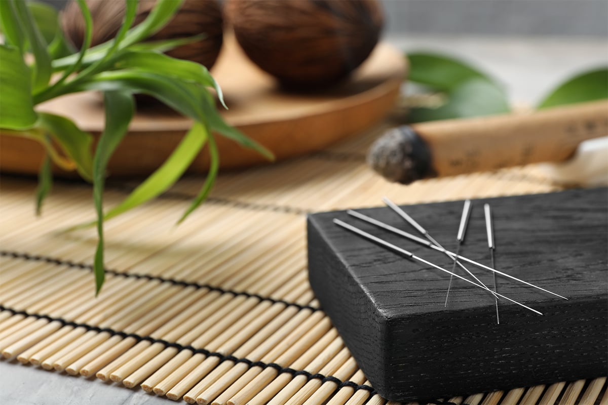 What is Acupuncture and How Does it Work? 