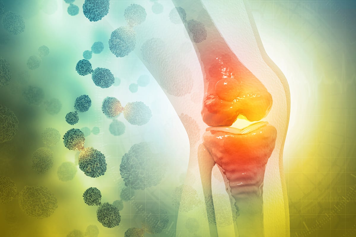 Inflammation's Effects on Bone Health